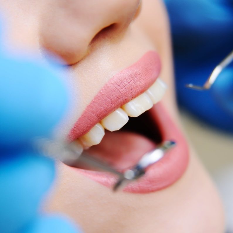 oral hygiene